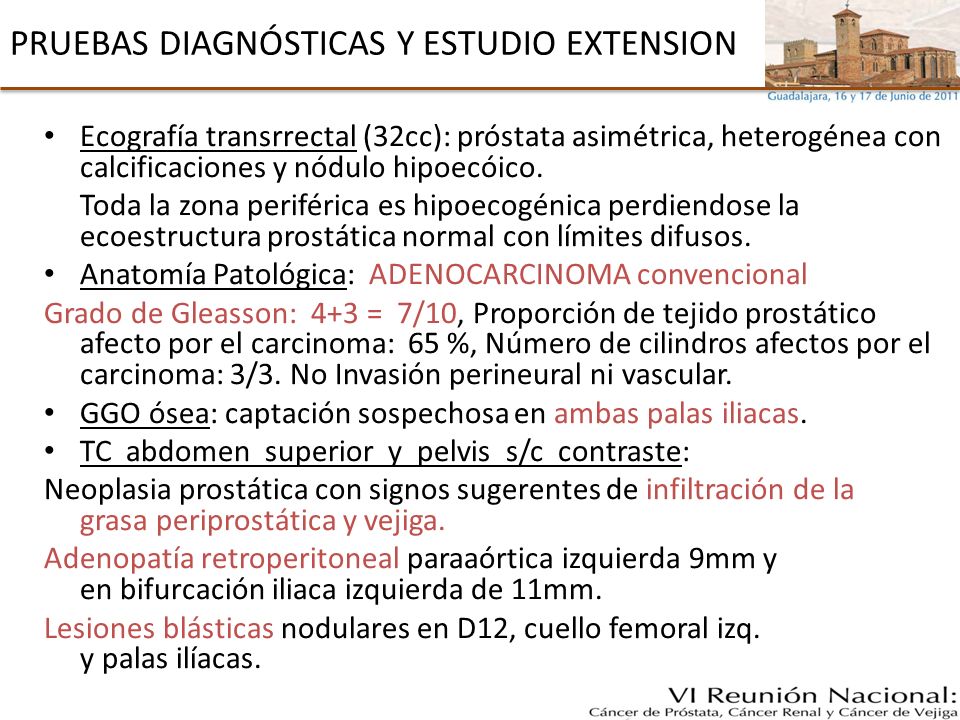prostata heterogenea